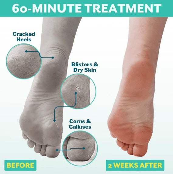 PoshPeel™️ Pedi-Cure