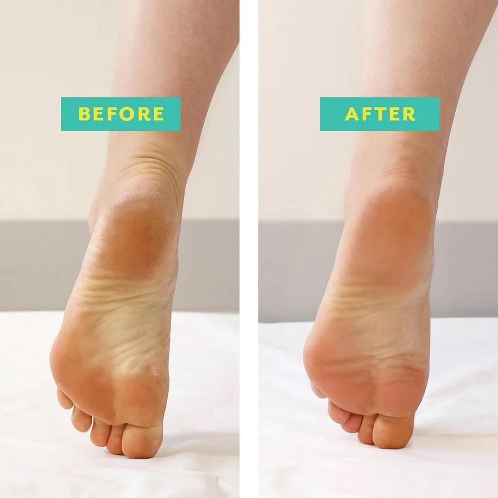 PoshPeel™️ Pedi-Cure